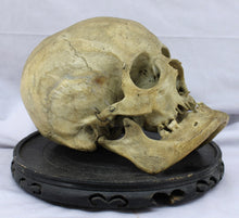 Load image into Gallery viewer, Human Skull with Craniosynostosis
